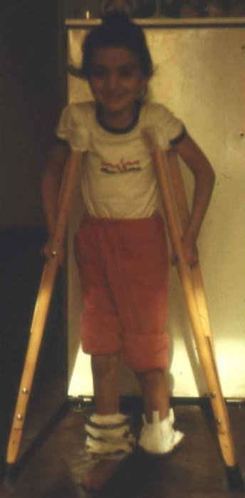 Пациентка Казбега Кудзаева, пострадавшая в результате землетрясения в 1988 году в городе Спитак